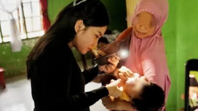 Warga Martubung Terharu, Bayi Sumbing Sembuh Berkat Pemko Medan